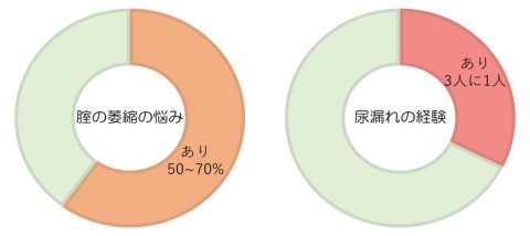 膣萎縮と尿漏れグラフ