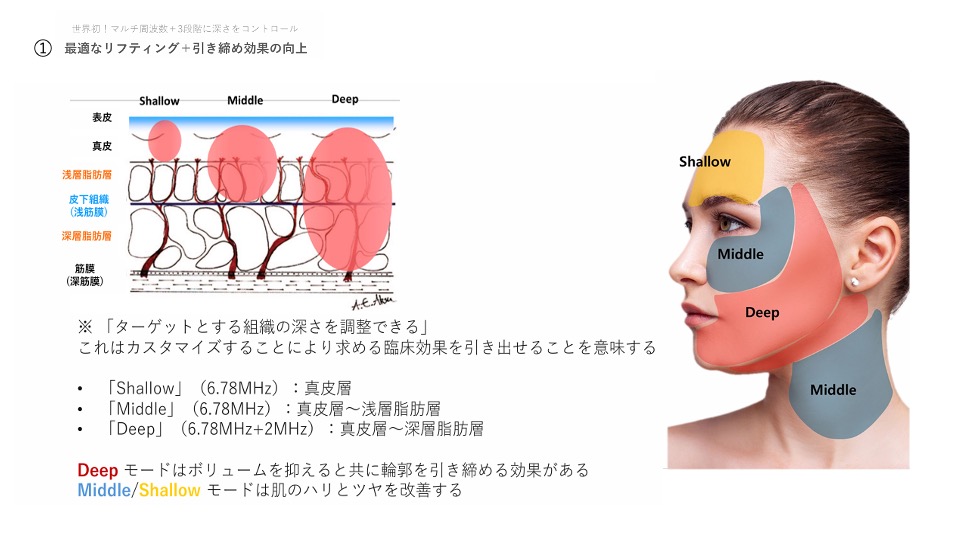 RF治療機械とXERFの違い
