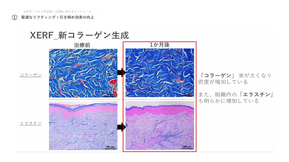 コラーゲン生成、エラスチン生成の上昇効果